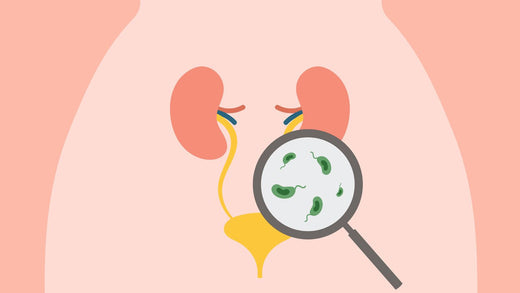 Urinary Tract Infection (UTI)